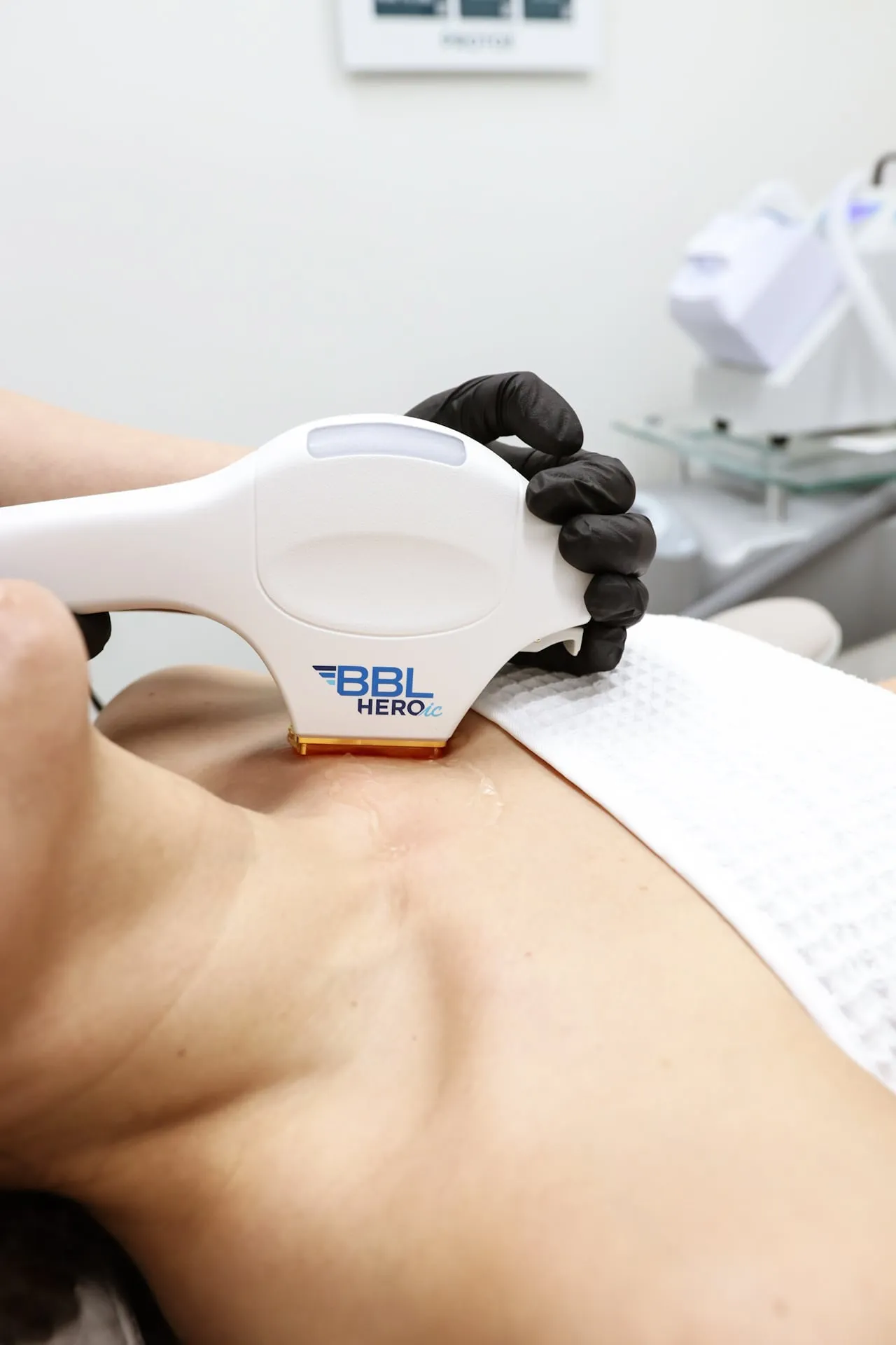 The BBL handpiece resting on a patient’s décolletage during a SkinTyte session